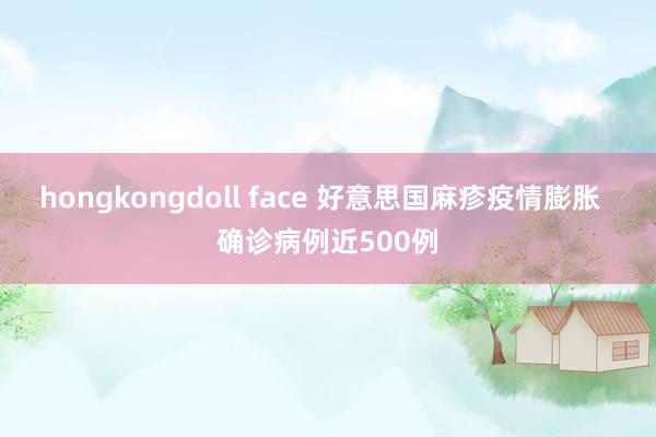 hongkongdoll face 好意思国麻疹疫情膨胀  确诊病例近500例
